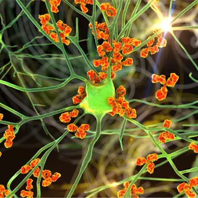 Autoimmunity