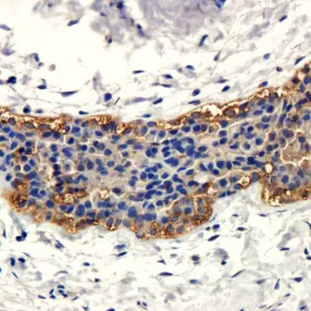 IHC