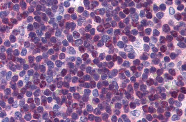 P27KIP1/CDKN1B (internal) Antibody