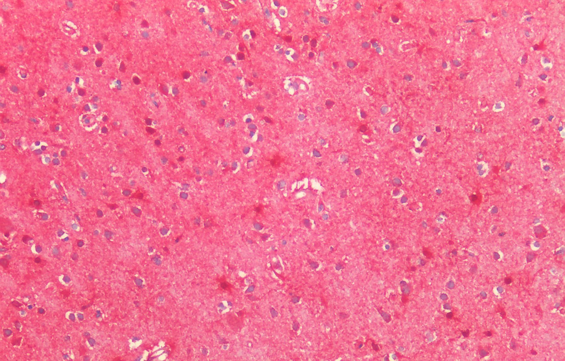 MNSOD (isoform A) Antibody