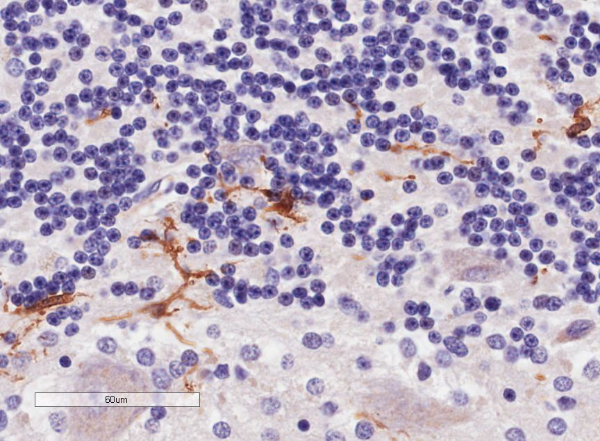 Goat anti-AIF1 / IBA1 (isoforms 1 + 3) Antibody