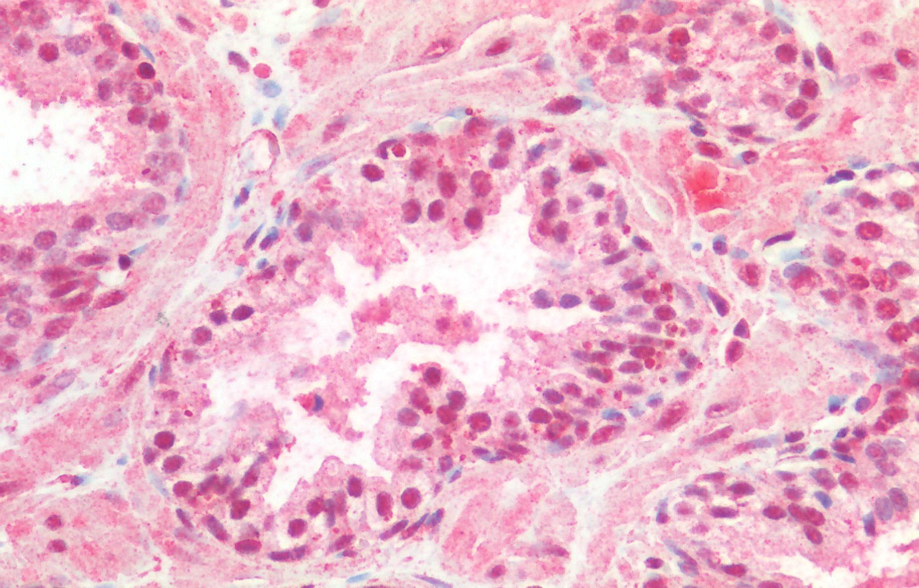 CREB1 (aa96-109) Antibody