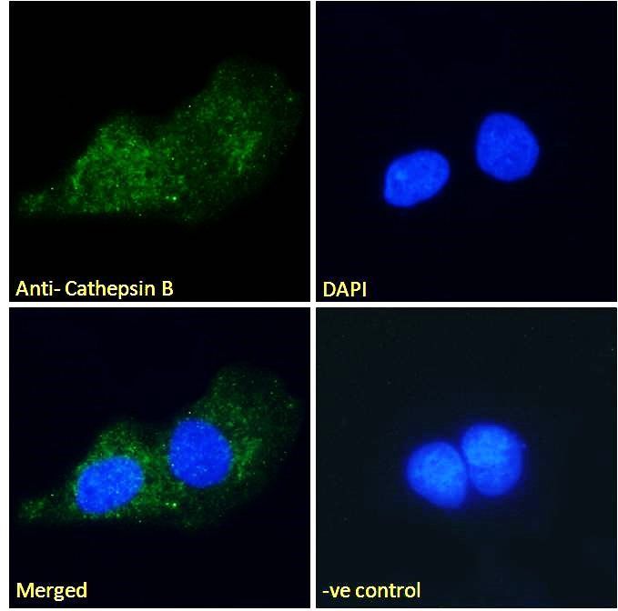 Cathepsin B Antibody