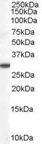 DDAH2 Antibody