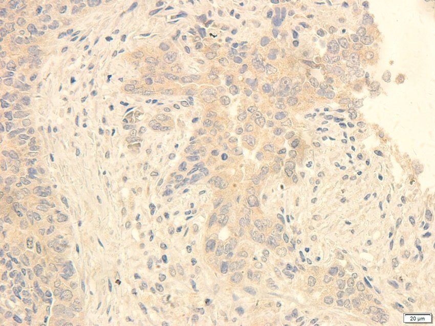TACD2 Rabbit Polyclonal Antibody