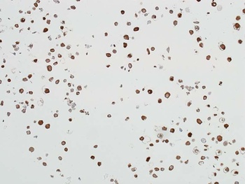 Rabbit ALDH1A1 Recombinant Monoclonal Antibody