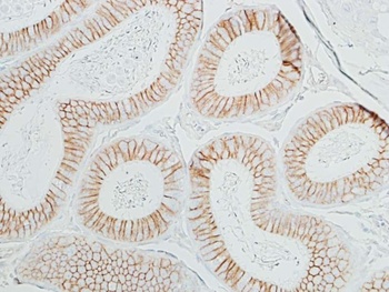 Rabbit beta Catenin Recombinant Monoclonal Antibody