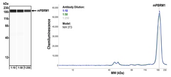 Rabbit PBRM1 Recombinant Monoclonal Antibody