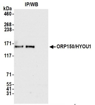 Rabbit ORP150/HYOU1 Antibody
