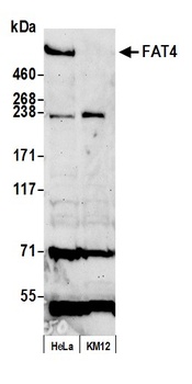 Rabbit FAT4 Antibody