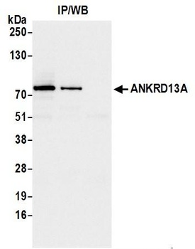 Rabbit ANKRD13A Antibody