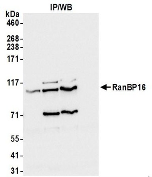 Rabbit RanBP16 Antibody