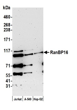 Rabbit RanBP16 Antibody