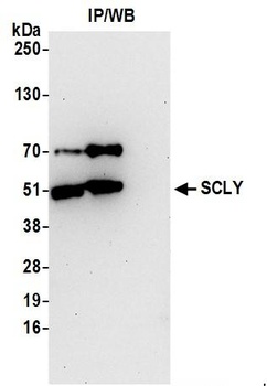 Rabbit SCLY Antibody