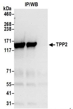 Rabbit TPP2 Antibody