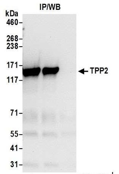 Rabbit TPP2 Antibody
