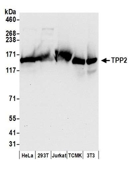 Rabbit TPP2 Antibody