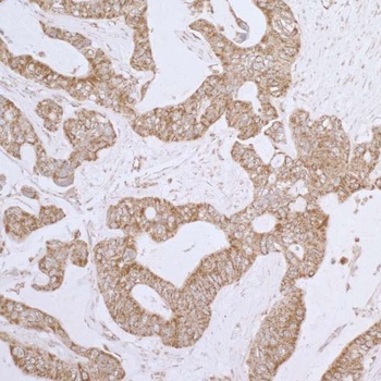 Rabbit DLD Antibody