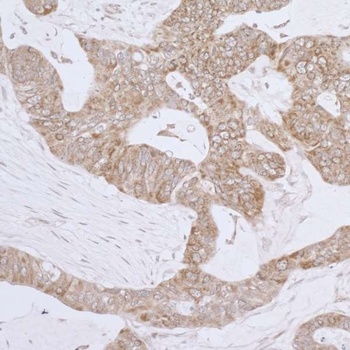 Rabbit LRPPRC Antibody