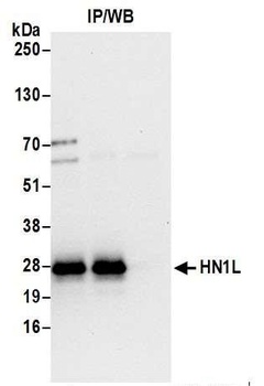 Rabbit HN1L Antibody