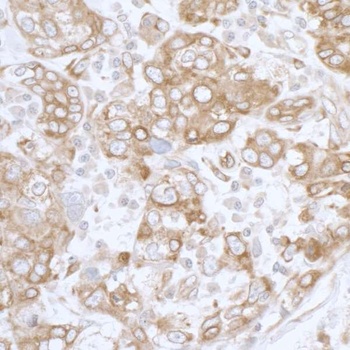 Rabbit PGRMC1 Antibody