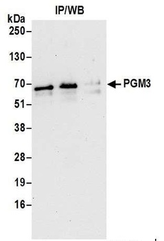 Rabbit PGM3 Antibody