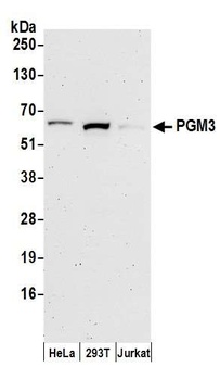 Rabbit PGM3 Antibody