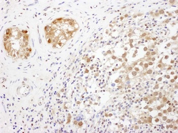 Rabbit TRAX Antibody