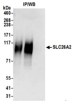 Rabbit SLC26A2 Antibody