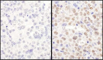 Rabbit LAS1L Antibody