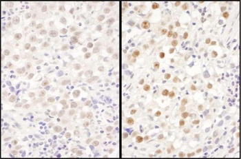 Rabbit LAS1L Antibody