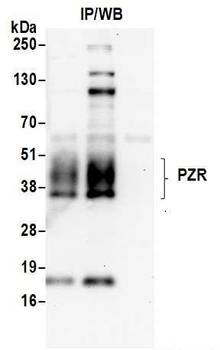 Rabbit PZR Antibody