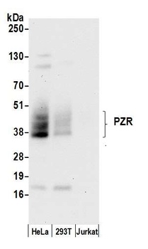 Rabbit PZR Antibody