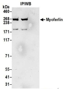 Rabbit Myoferlin Antibody