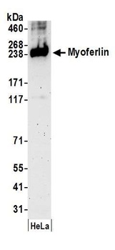 Rabbit Myoferlin Antibody