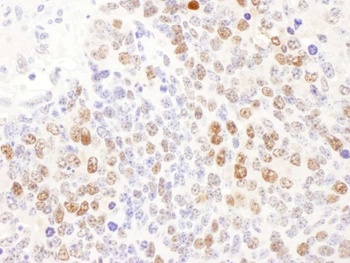 Rabbit DCK Antibody
