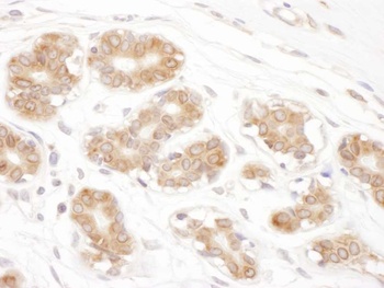 Rabbit RPN2 Antibody