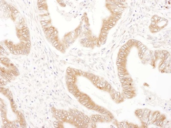 Rabbit RPN2 Antibody
