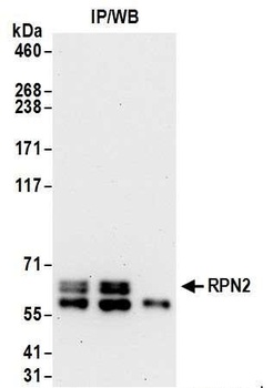 Rabbit RPN2 Antibody