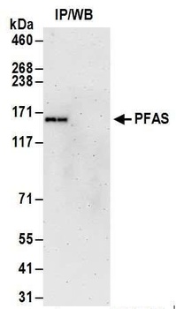 Rabbit PFAS Antibody