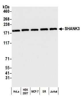 Rabbit SHANK3 Antibody