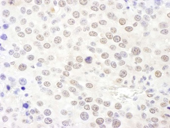 Rabbit NHP2L1 Antibody