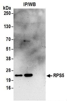 Rabbit RPS5 Antibody