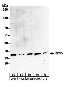 Rabbit RPS5 Antibody