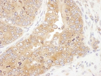 Rabbit RPS5 Antibody