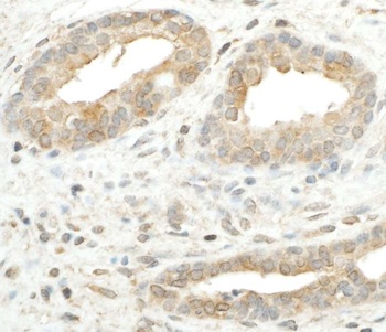 Rabbit RPS5 Antibody