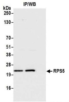 Rabbit RPS5 Antibody