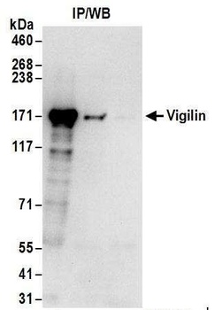 Rabbit Vigilin Antibody