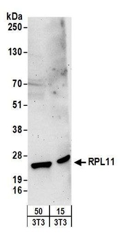 Rabbit RPL11 Antibody