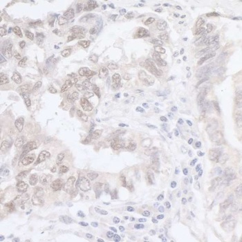 Rabbit ADAR1 Antibody
